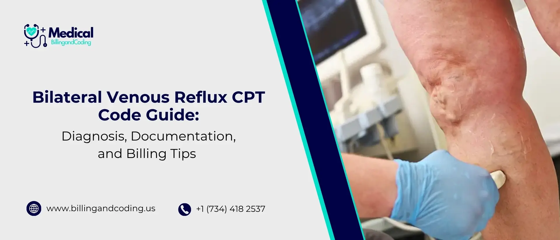Bilateral Venous Reflux CPT Code Guide Diagnosis, Documentation, and Billing Tips .jpg