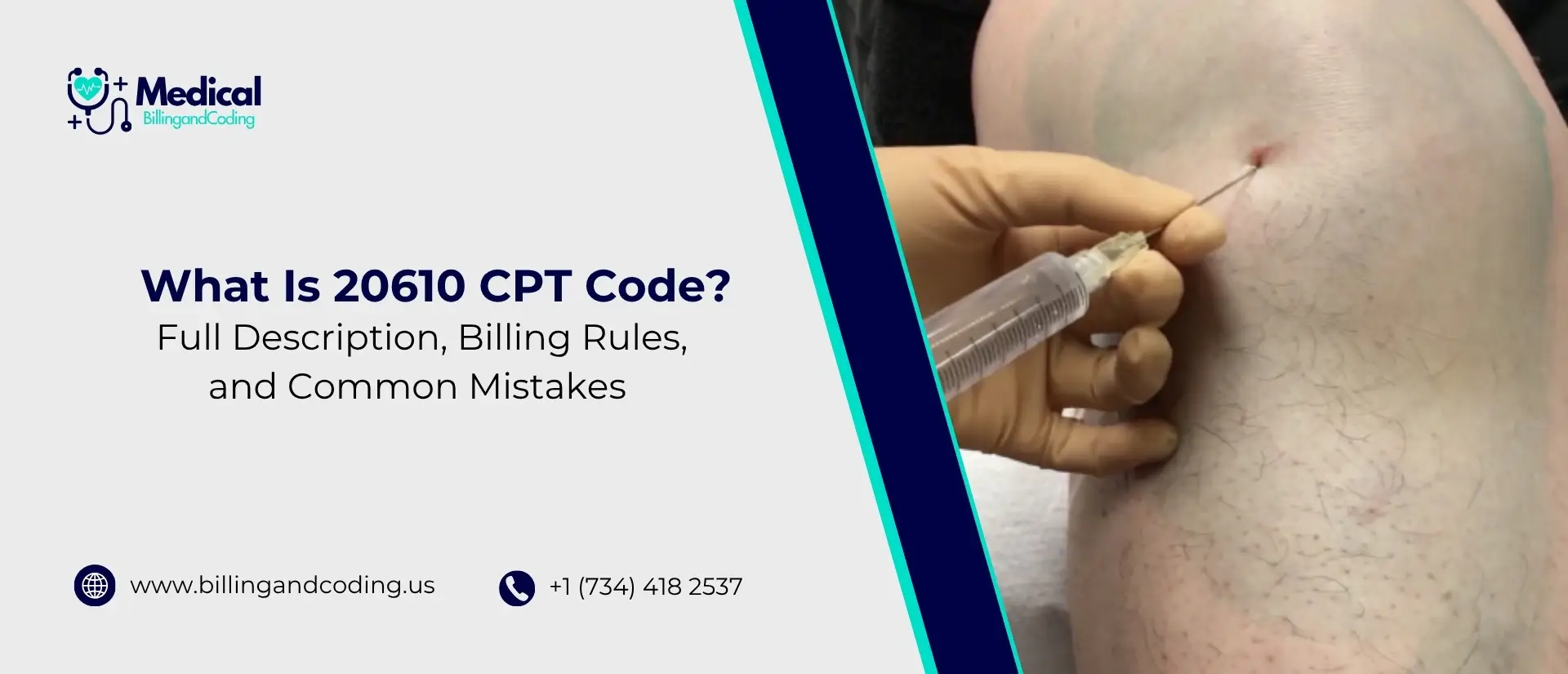 What Is 20610 CPT Code Full Description, Billing Rules, and Common Mistakes