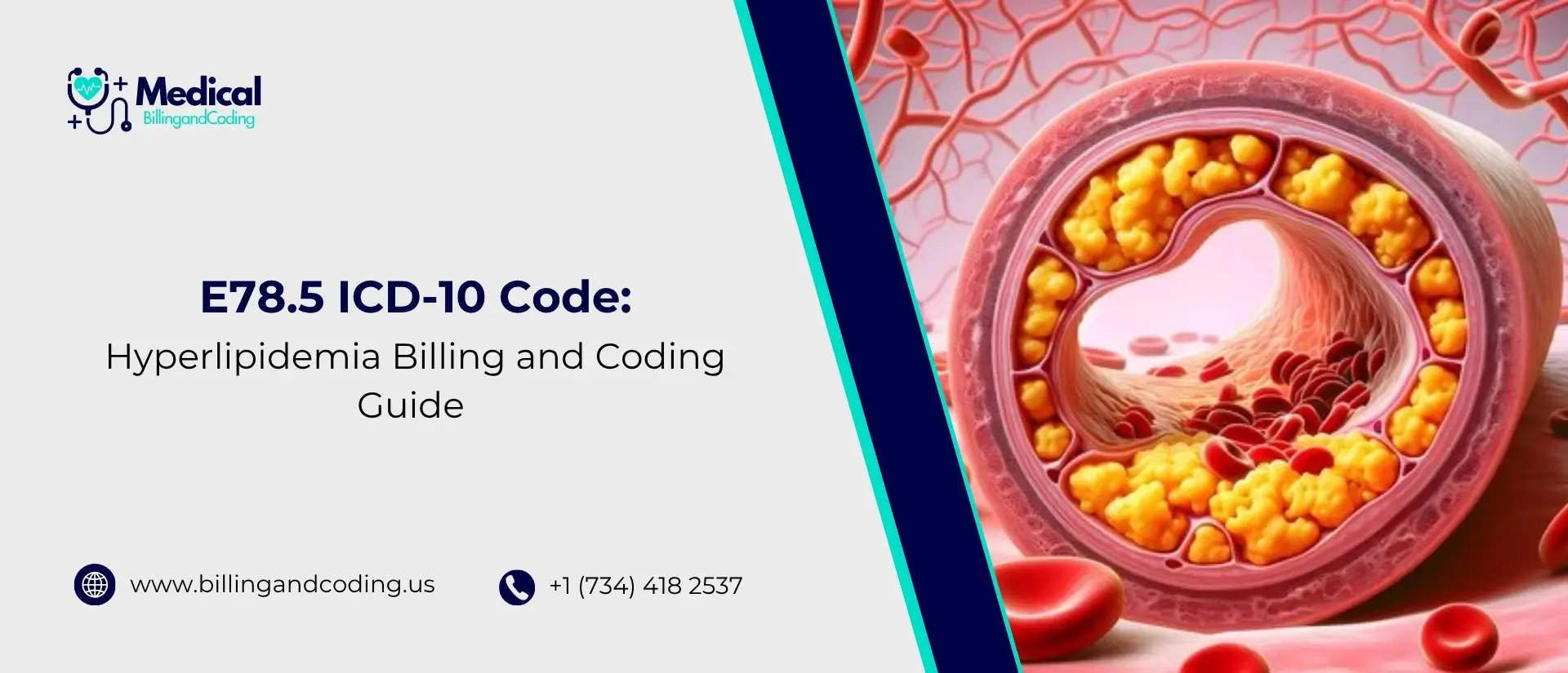 E78.5 ICD-10 Code Hyperlipidemia Billing and Coding Guide.jpg